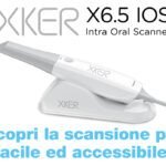 Applicazioni dello scanner intraorale nell’ambito dell’ortodonzia